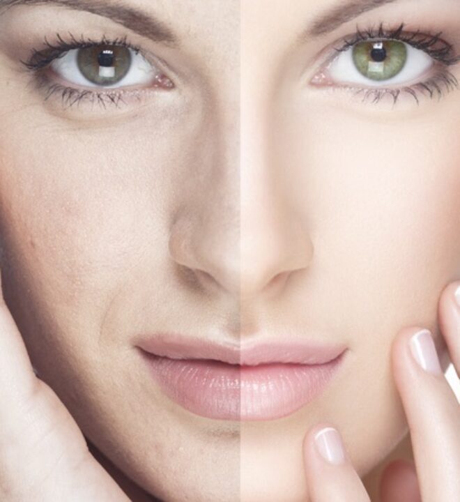 Bedah-Kosmetik-660x720